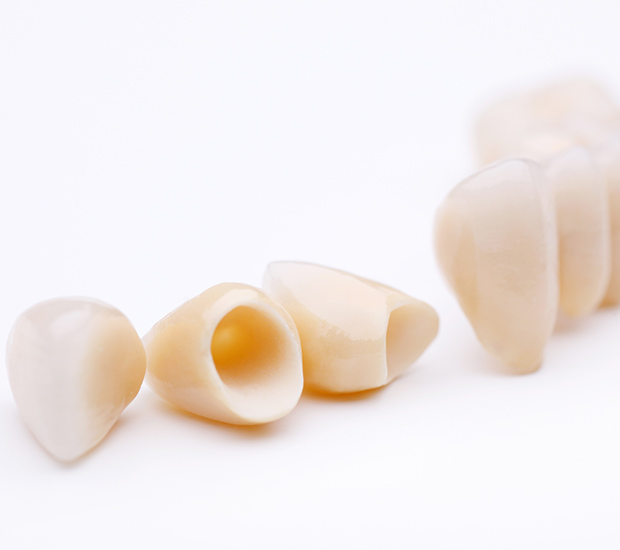 Ballston Spa Dental Crowns and Dental Bridges